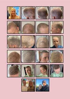 Deborah's story HAIR REBORN